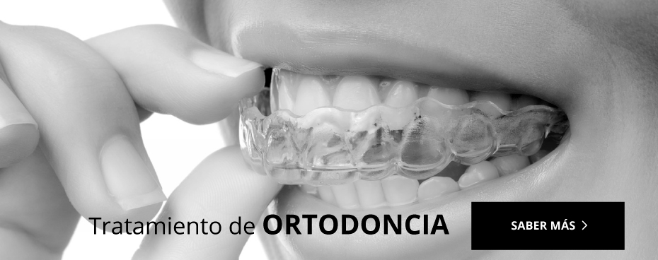 Ortodoncia Albacete | Chinchilla