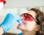 riesgos del blanqueamiento dental