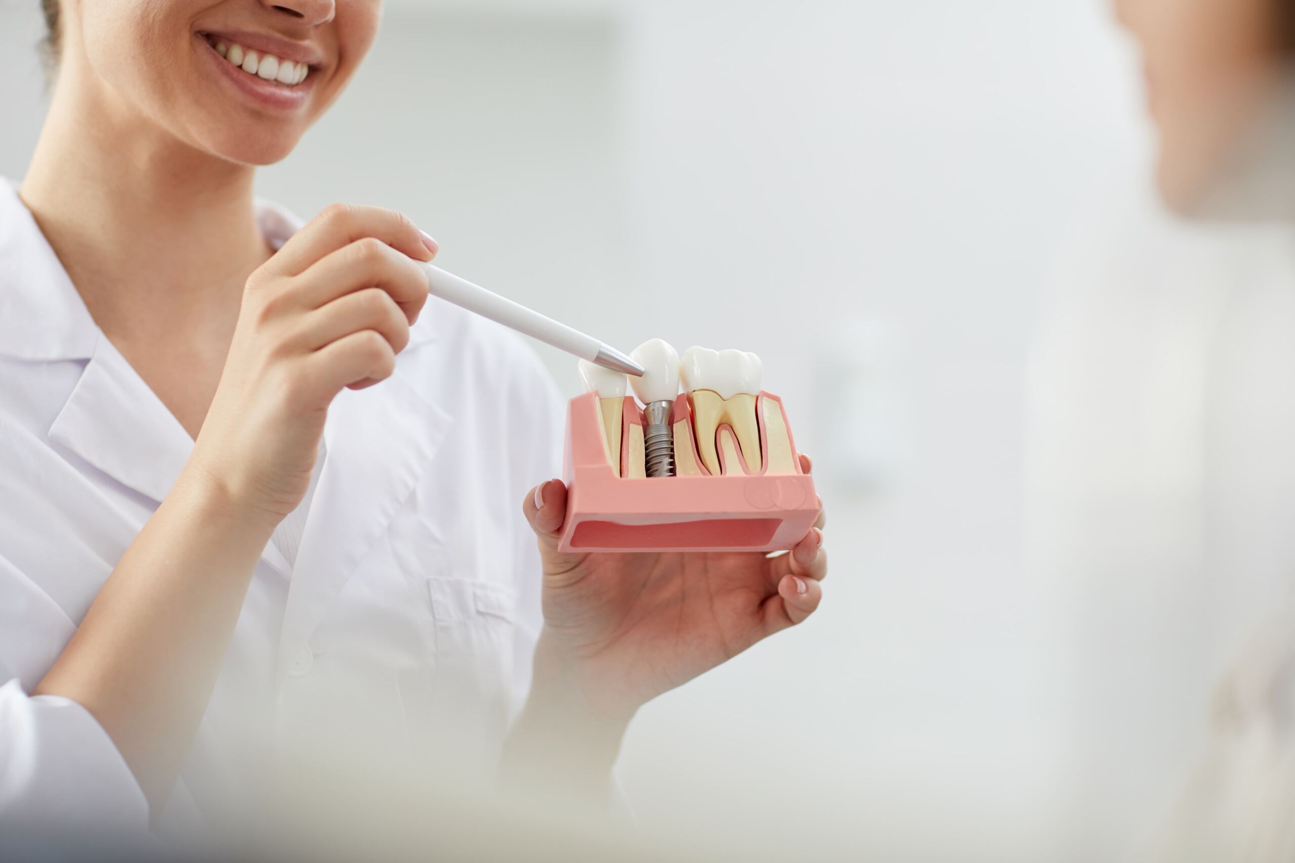 Transformando sonrisas con la Revolucion de los Implantes Dentales Altozano