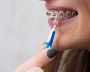 consejos para brackets recien puestos